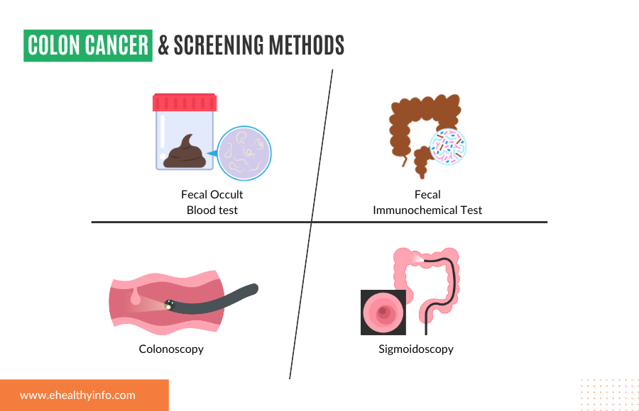 Colon Cancer Screening Guidelines