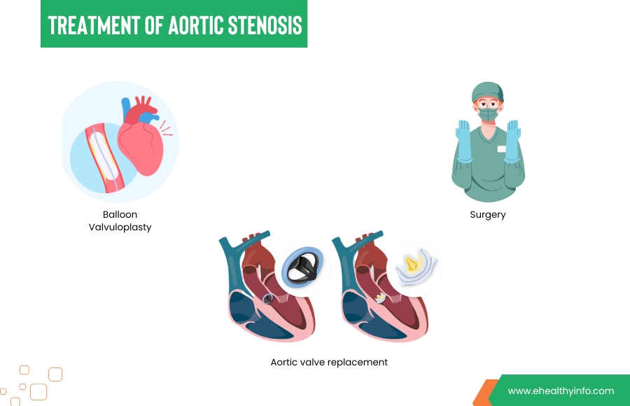 Aortic Stenosis Treatment