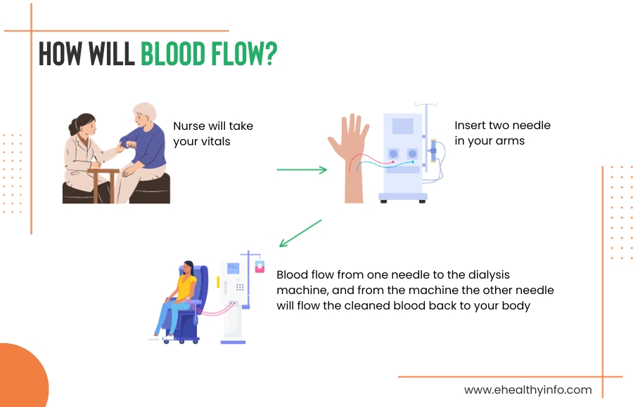 Hemodialysis Procedure