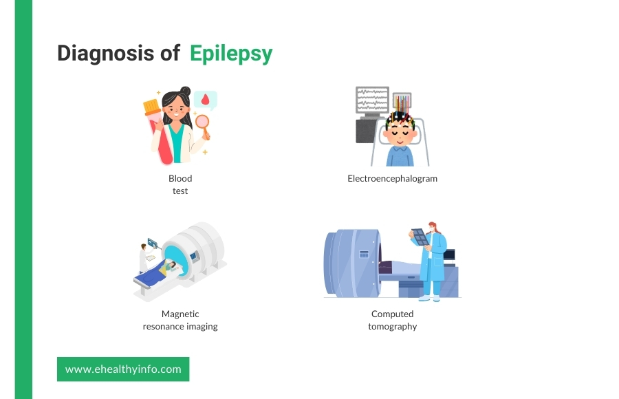 epilepsy diagnosis