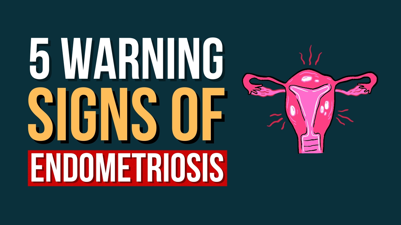 What Are The Signs Of Endometriosis?