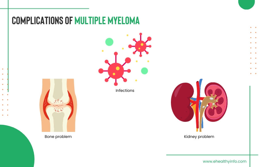 Complications Of Multiple Myeloma