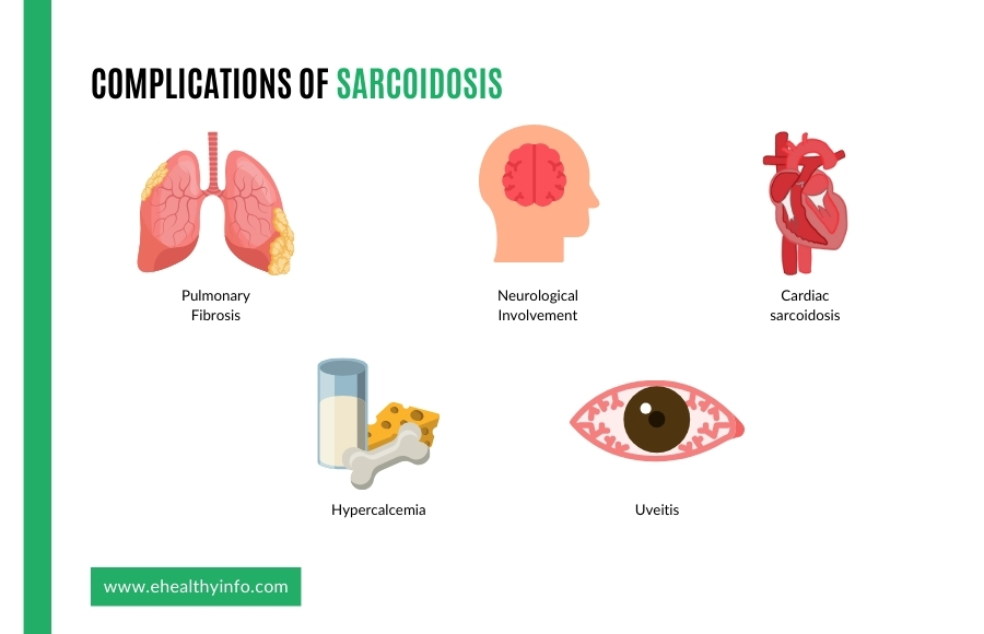 sarcoidosis complications