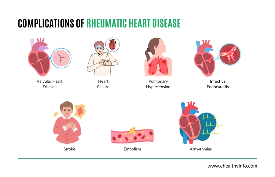 rheumatic heart disease complications