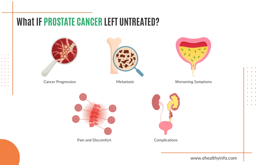 What happens if prostrate cancer is left untreated?