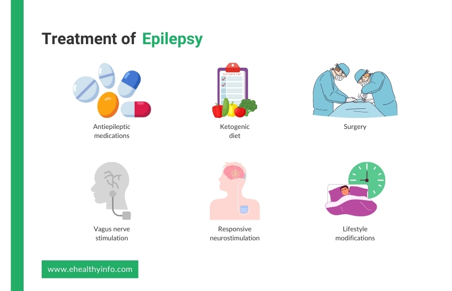 epilepsy treatment