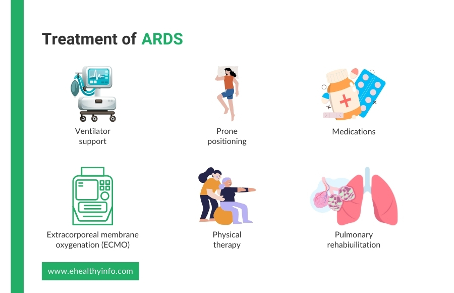 ARDS Treatment