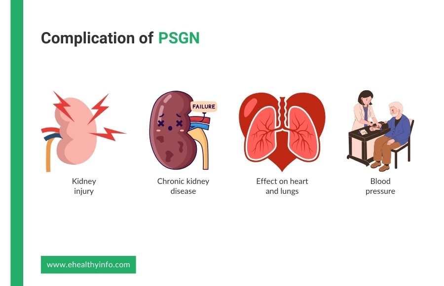 Complications of PSGN