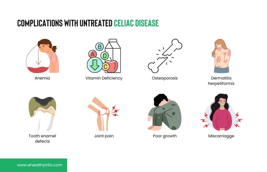 Complications With Untreated Celiac Disease