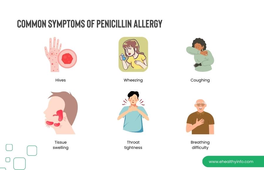 Common symptoms of penicillin allergy