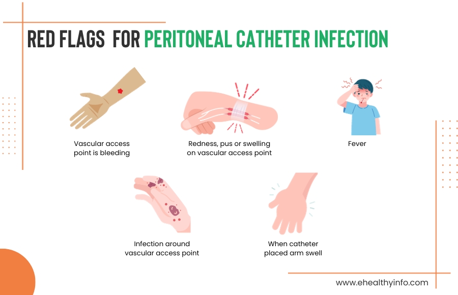 Signs Of Peritoneal Catheter Infection