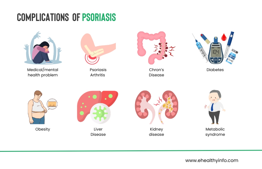 What Are The Complications Of Psoriasis?