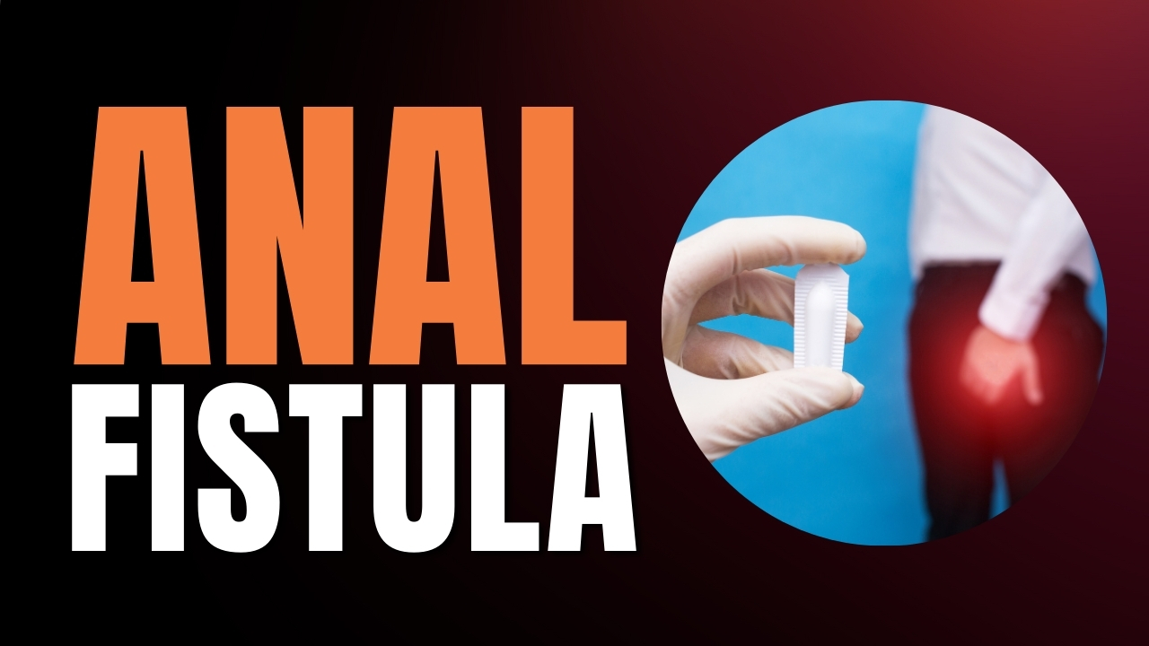 Is Anal Fistula Dangerous? – Find Out Symptoms, Causes & Treatment