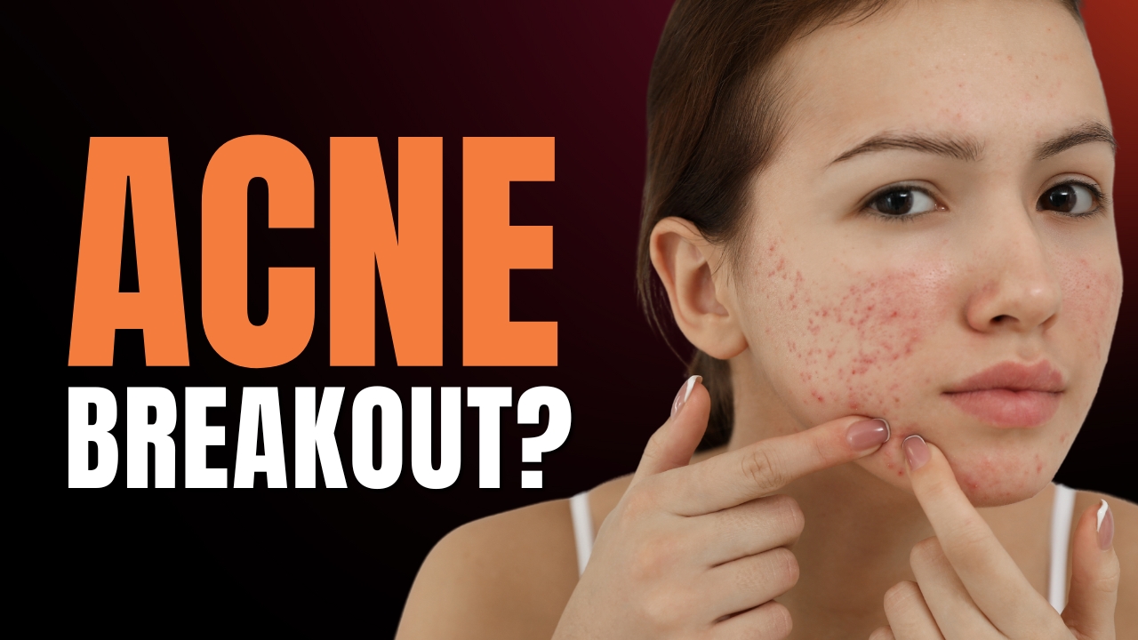 Explore The Different Types of Acne