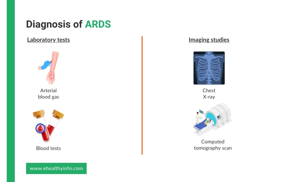 Acute Respiratory Distress Syndrome Diagnosis