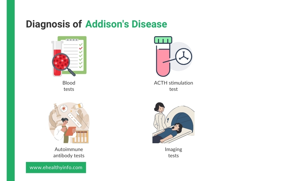 Diagnosis of Addison's Disease