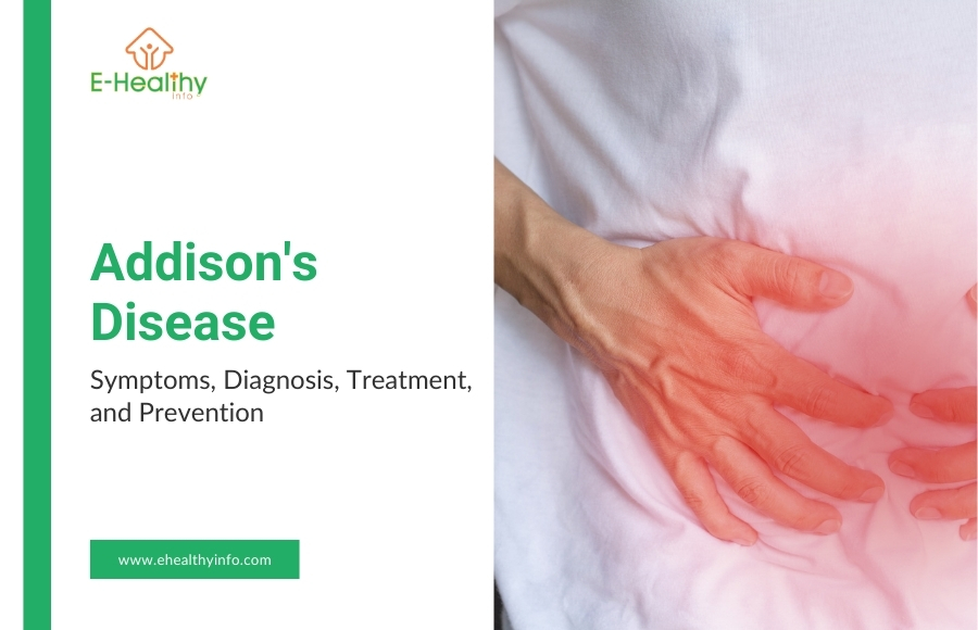 Addison’s Disease – Key Symptoms, and Proven Treatment Strategies