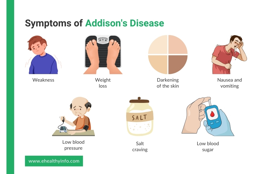 Symptoms of Addison's Disease