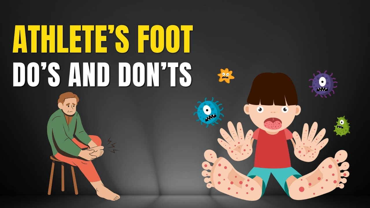 What to do if you have athlete’s foot?