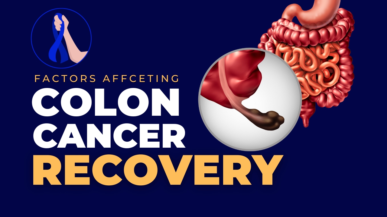 What Are The Factors Affecting Colon Cancer?