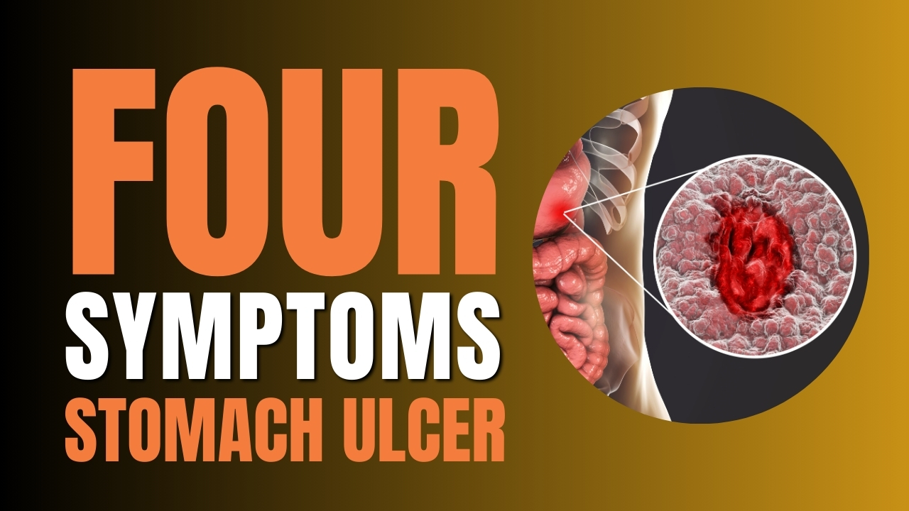 What Is Stomach Ulcer? Here Are The 4 Signs Of Stomach Ulcer