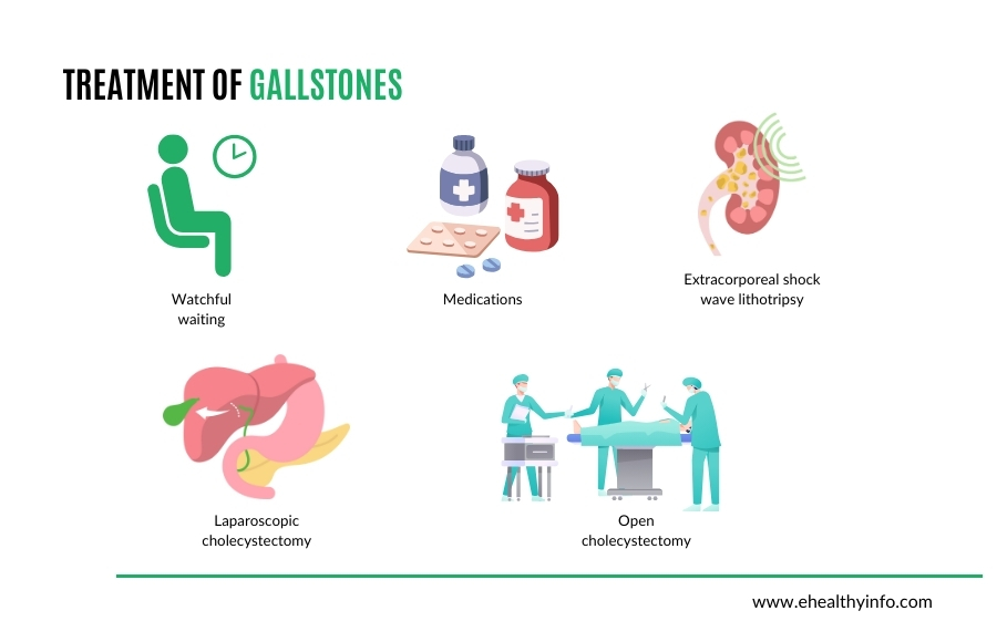gallstones treatment