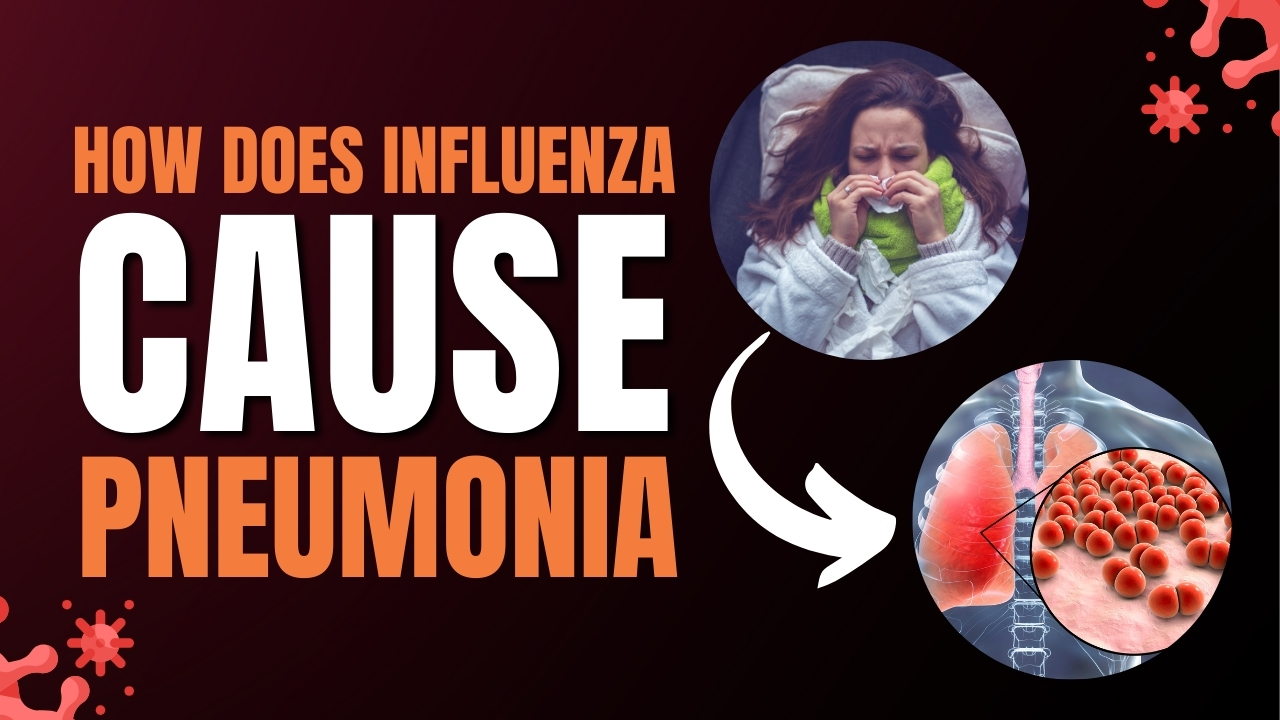 How Does Influenza Cause Pneumonia?