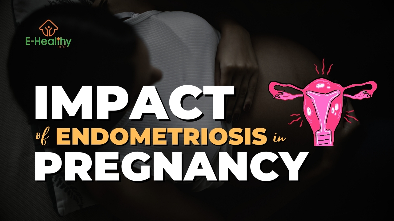 The Impact of Endometriosis on Pregnancy Journey