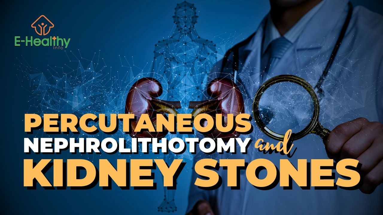 Blast Away Kidney Stones with Percutaneous Nephrolithotomy