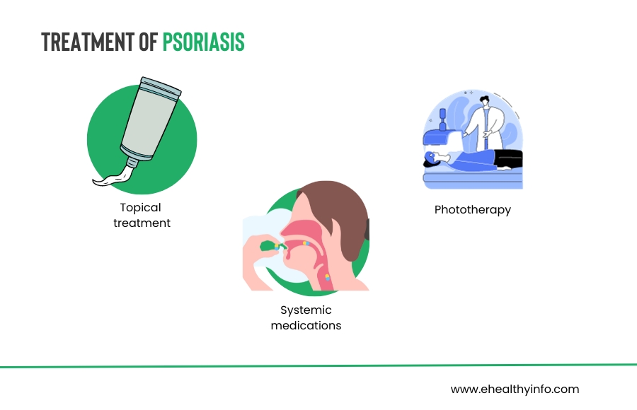 Psoriasis Treatment