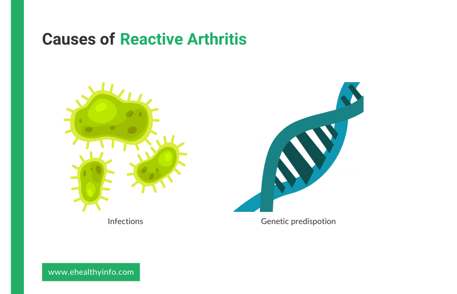 Causes of Reactive Arthritis