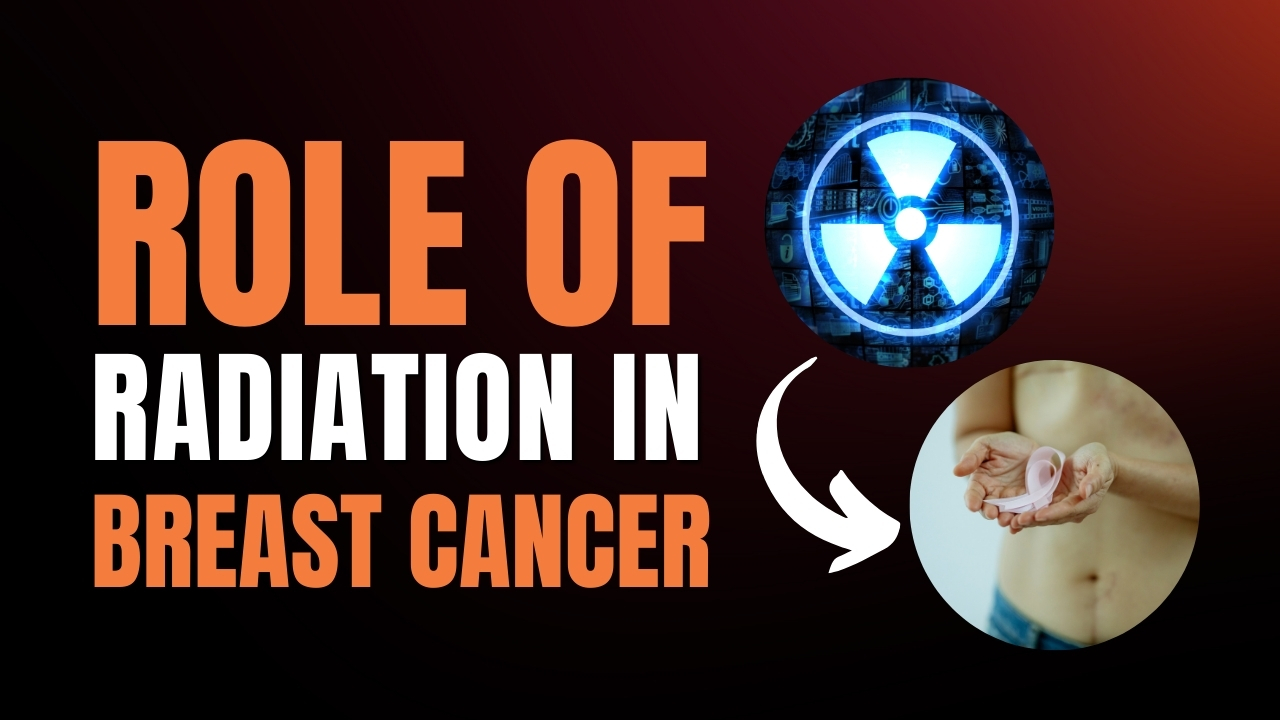 How Radiation Therapy Works for Breast Cancer?