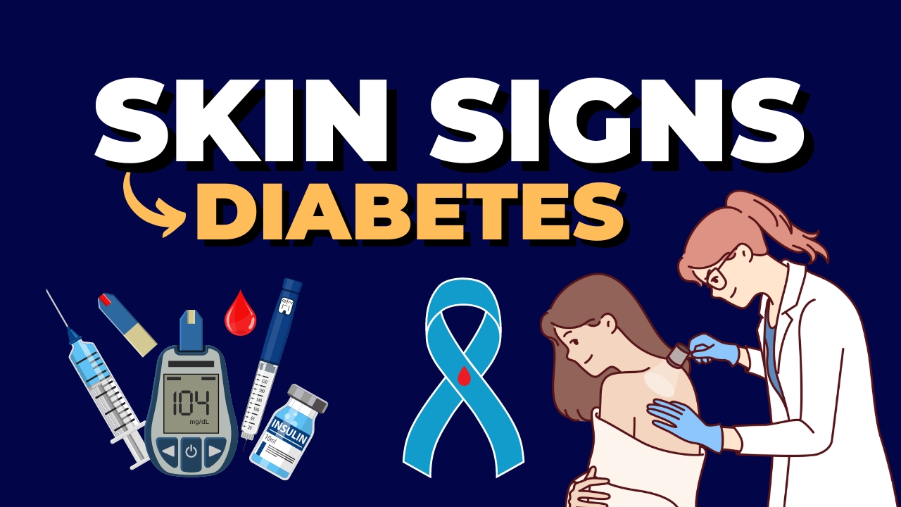 3 Skin Signs Of Diabetes