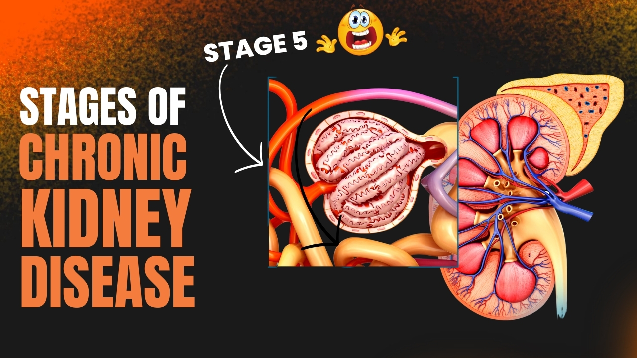 Shocking Truth Behind Every Stages Of Chronic Kidney Disease