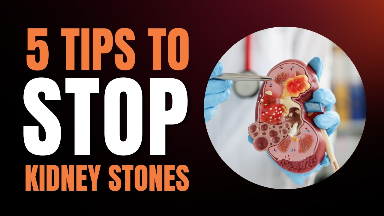 What Can You Do To Prevent Kidney Stones?