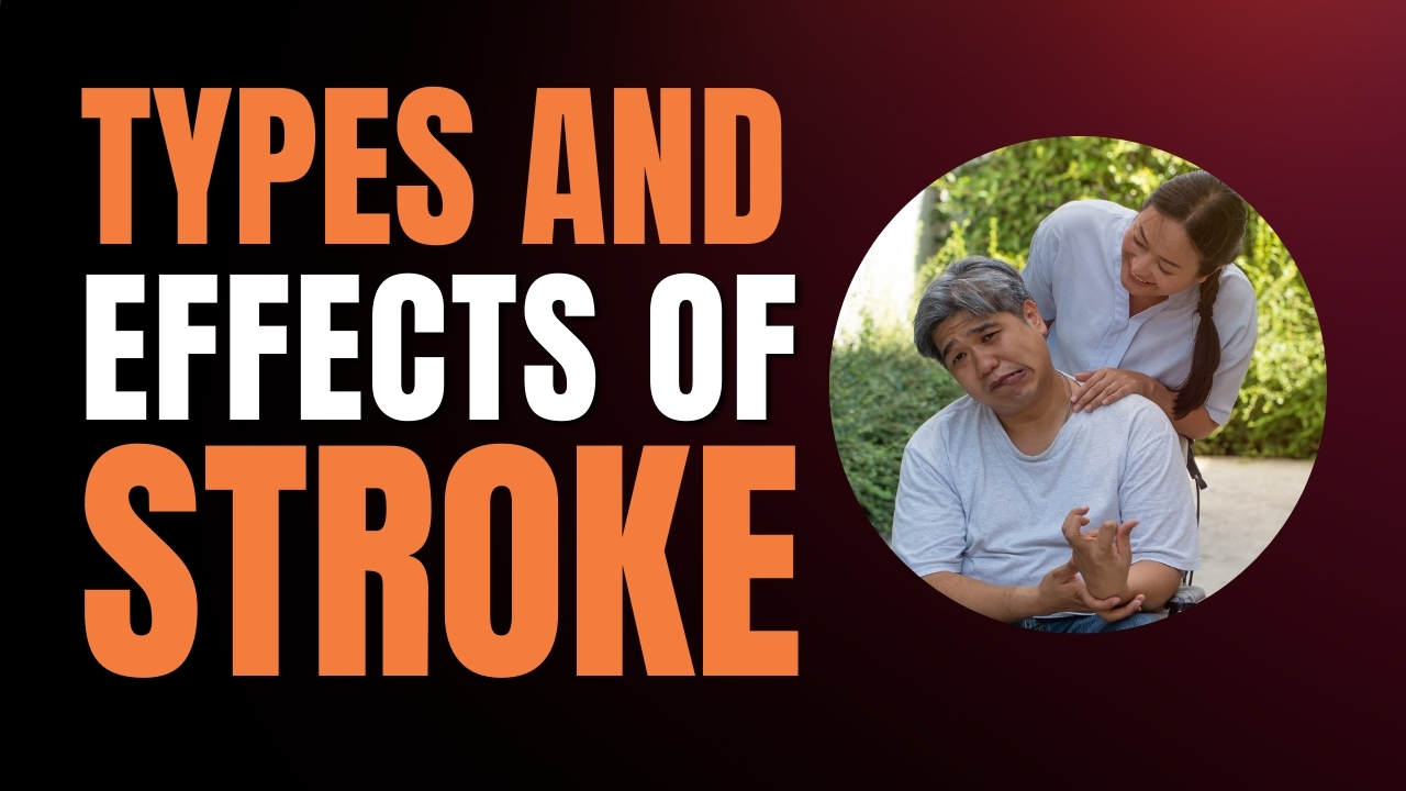 Types Of Strokes In Brain – Ischemic stroke & Hemorrhagic stroke