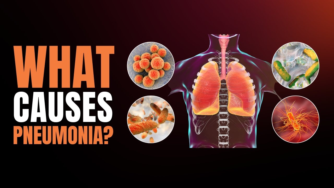 What Causes Pneumonia In The Lungs?