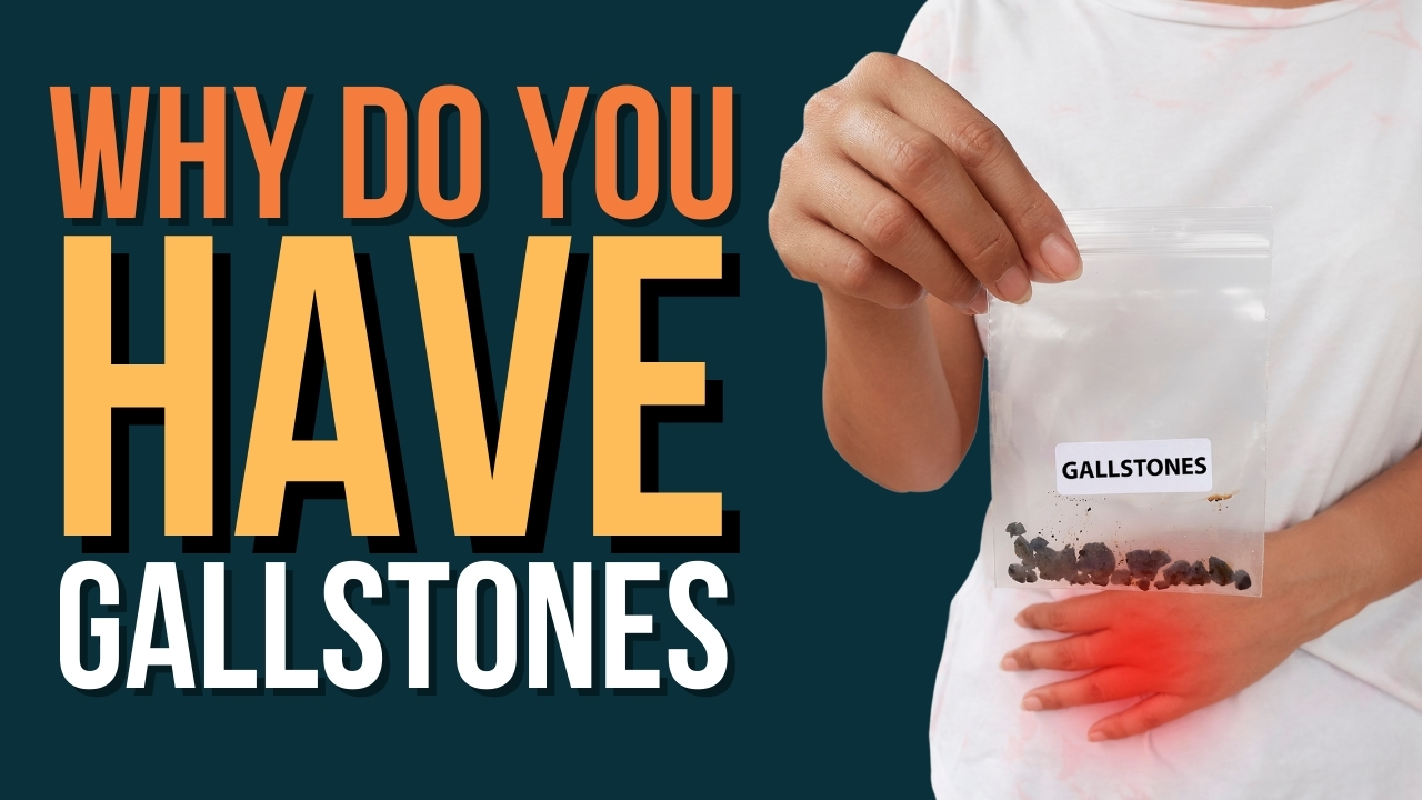 Explore The Diverse Causes That Contribute To Gallstone Development