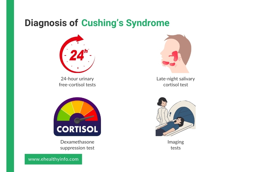 cushing's syndrome diagnosis