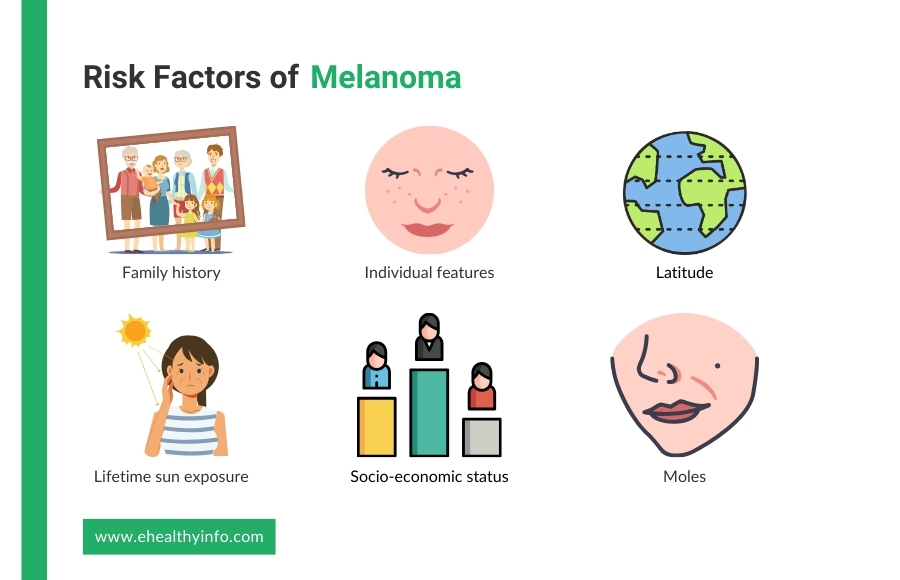 melanoma risk factors