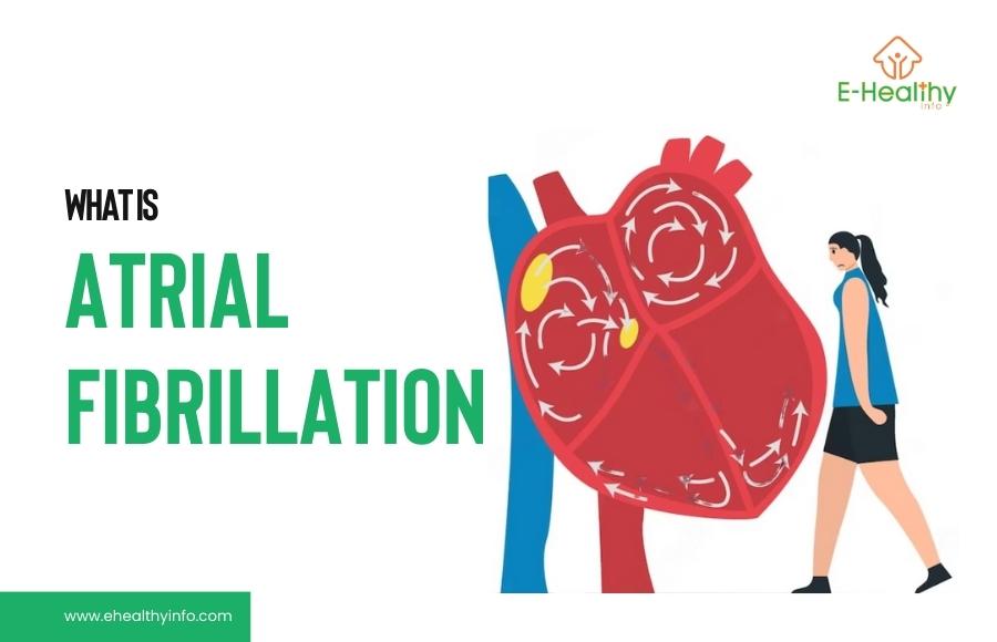 Atrial Fibrillation | Unveiling Effective Treatment Strategies for AFib