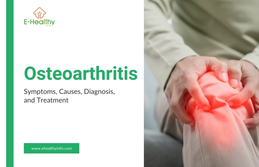 Understanding Osteoarthritis: Symptoms, Causes, Diagnosis, and Treatment