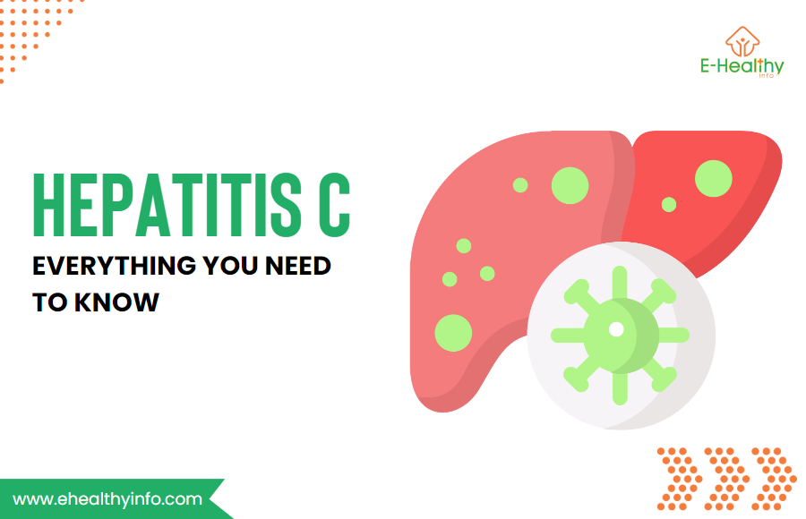 Hepatitis C