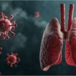 Pneumonia – Symptoms, Causes & Fast Recovery Tips