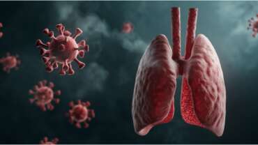 Pneumonia – Symptoms, Causes & Fast Recovery Tips