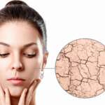 The zoom circle shows dry facial skin before moistening