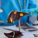 doctor holding human anatomy model for study diagnosis and treatment of hepatitis a in hospital