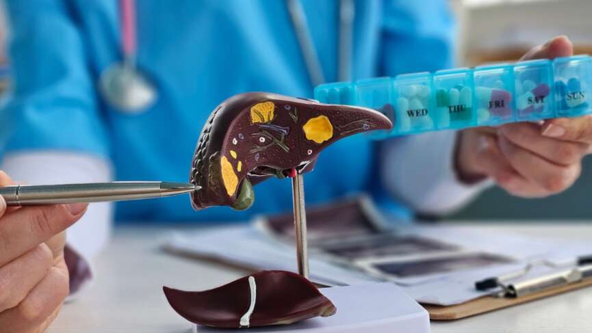 doctor holding human anatomy model for study diagnosis and treatment of hepatitis a in hospital