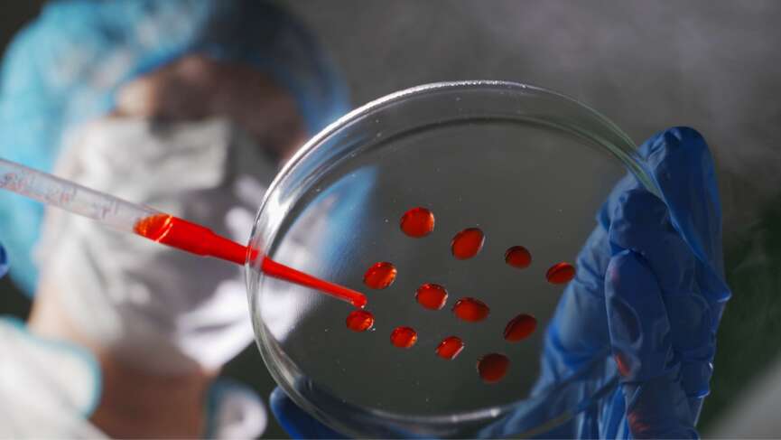 Researchers pipette samples in well microplate medical test of blood or DNA to test aplastic anemia
