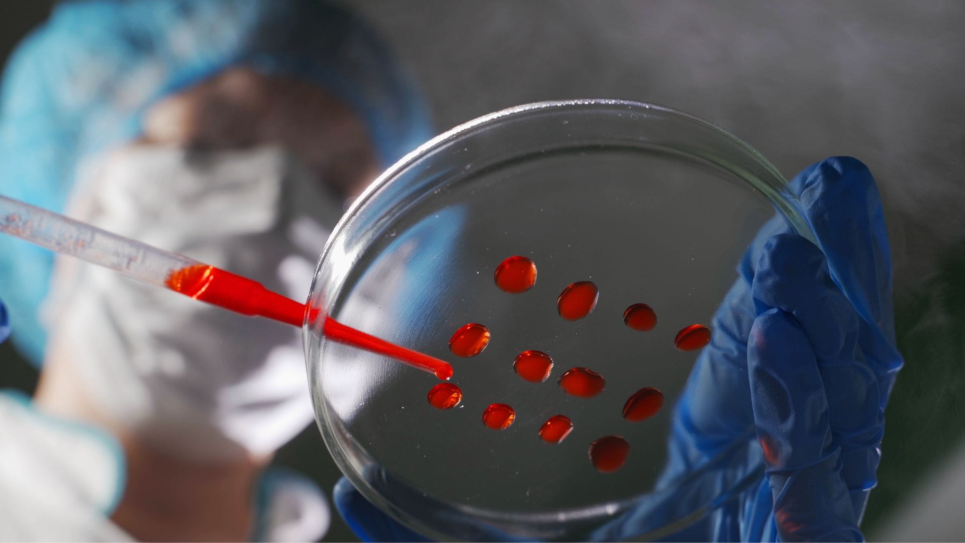 Researchers pipette samples in well microplate medical test of blood or DNA to test aplastic anemia